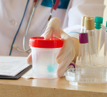 המטוריה: דם בשתן - חובה להיבדק-תמונה